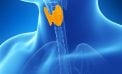 What’s Causing Thyroid Cancer to Soar? What’s Causing Thyroid Cancer to Soar?
