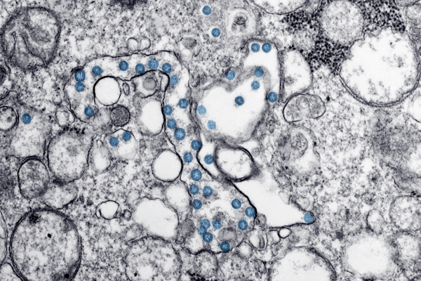 covid virus