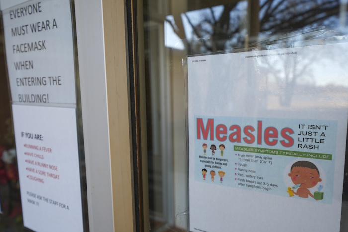 measles sign